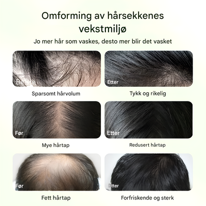 Shampoo med Batanaolje - Hårvekst og Pleie